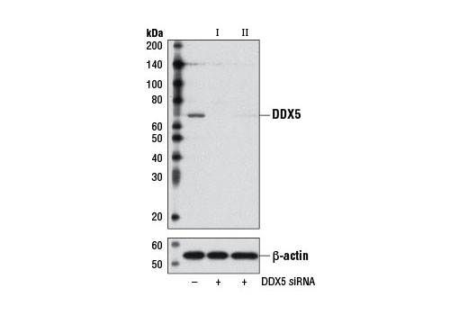 rna sup ala