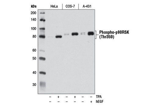 Phosphop90RSK (Thr359) (D1E9) を用いた、一晩飢餓させ、未処理 (-)、またはTPA (200 nM, 15 min) またはHuman Epidermal Growth Factor (hEGF) (100 ng/mL, 15 min) で処理した (+) HeLa、COS-7、およびA-431細胞からの抽出物のWB解析。