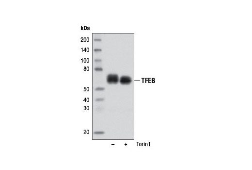 Tfeb Antibody Cst