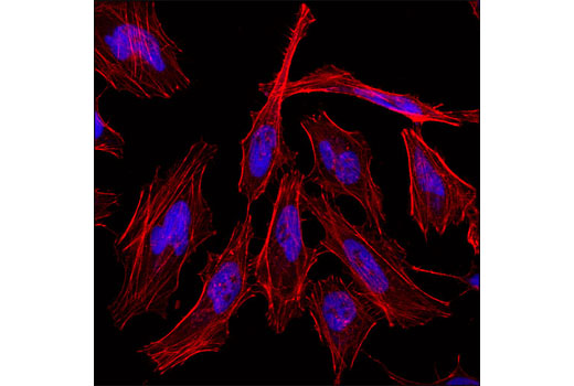 Histone H3 (D1H2) XP® Rabbit mAb (Alexa Fluor® 647 Conjugate) | Cell ...