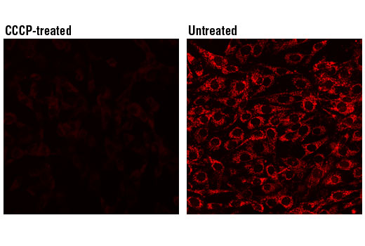 Cst Mitochondrial Membrane Potential Assay Kit Ii