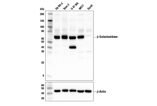 B Galactosidase E2u2i Rabbit Mab Cell Signaling Technology