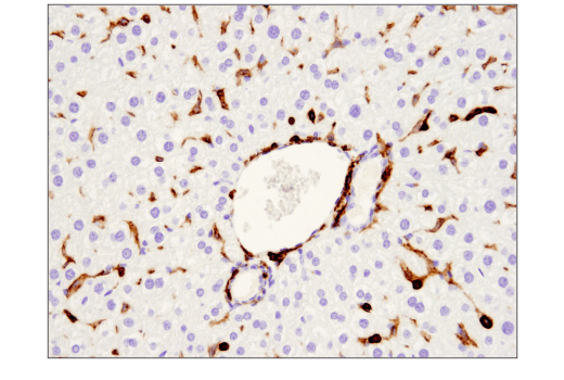 パラフィン包埋したマウス肝臓を、CD45 (D3F8Q) を用いて免疫組織化学染色で解析しました。予測されたように、CD45ネガティブ肝細胞は染色されないことに注意してください。