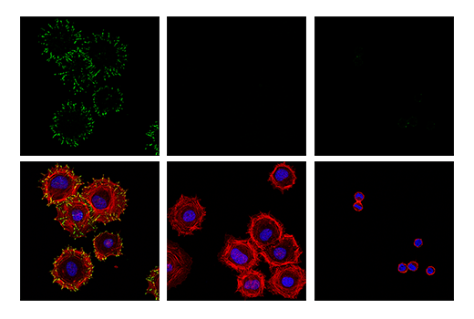 HeLa細胞を0.04%トリプシンと0.03% EDTAで剥離して 無血清培地に1時間懸濁しました。細胞を懸濁したまま (右)、または固定の1時間前にフィブロネクチンでコーティングしたスライドに播種し (左)、免疫細胞化学染色を行いました。また、リン酸化の特異性を確認するため、接着させた細胞をλ-ホスファターゼで後処理しました (中央)。