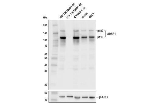 Adar1 E6x9r Xp Rabbit Mab Cell Signaling Technology