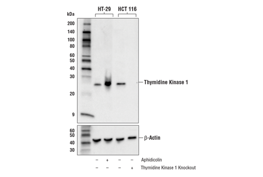 Thymidine Kinase 1 (E2H7Z) Rabbit mAb (上) またはβ-Actin (D6A8) Rabbit mAb #8457 (下) を用いた、Mock処理 (-) またはアフィジコリン処理 (10 μg/ml, 24 hr; +) したHT-29細胞、および野生型 (-) またはチミジンキナーゼ1ノックアウト (+) HCT116細胞からの抽出物のウェスタンブロット解析。