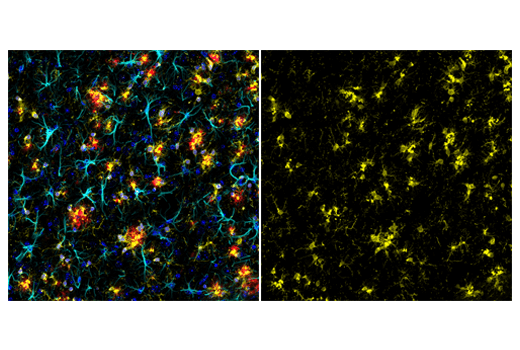 Iba1 Aif 1 E4o4w Xp Rabbit Mab Alexa Fluor 555 Conjugate Cell Signaling Technology