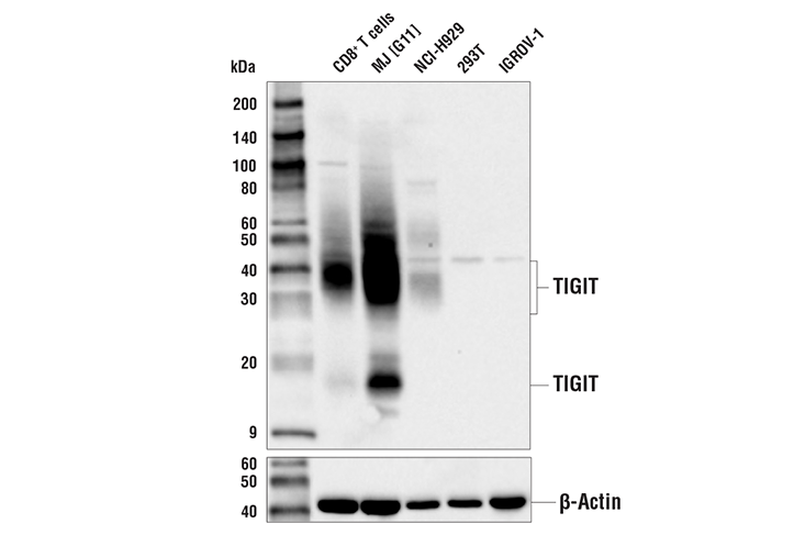Tigit E5y1w Xp Rabbit Mab Cell Signaling Technology