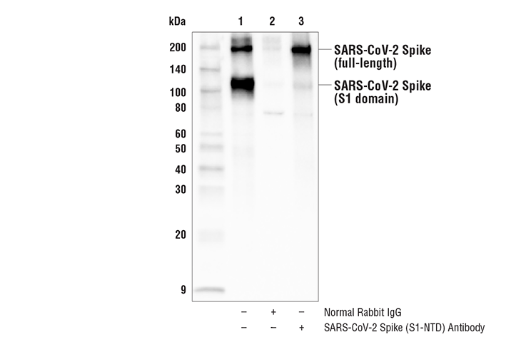 spike protein igg antibody test