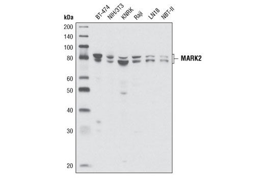 Western Blotting