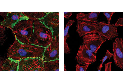 cd31 (pecam-1) (89c2) mouse mab #3528