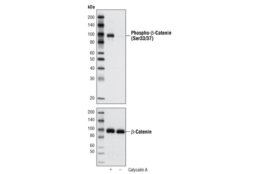 Phospho B Catenin Ser33 37 Antibody Cell Signaling Technology