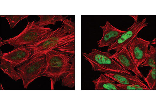 Confocal ICC analysis of HeLa cells, untreated (left) or anisomycin-treated (right), using Phospho-c-Jun (Ser73) (D47G9) (green). Actin filaments have been labeled with DY-554 phalloidin (red).