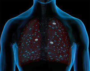 Digital illustration of human upper body with a scientific signaling
        pathway overlaid onto lungs to represent lung cancer signaling.