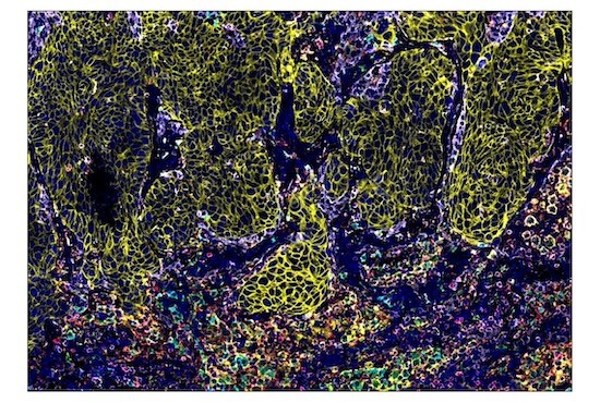 Mid-plex antibody panels