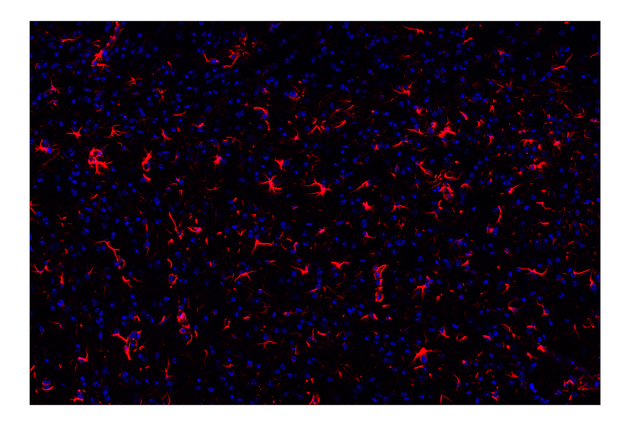 GFAP (E4L7M) XP® Rabbit mAb (Alexa Fluor® 647 Conjugate) #15913