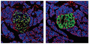 Pdx1 Antibody #2437 performance is assessed on appropriate tissues.