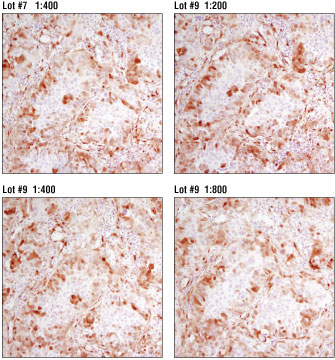 パラフィン包埋ヒト結腸がんの連続切片のIHC解析