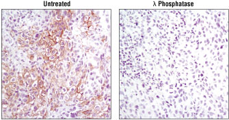Phosphatase treatment of paraffin-embedded human lung carcinoma using #3077