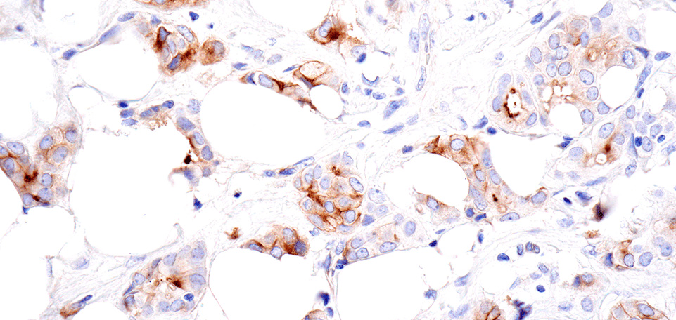 CD109 (E4I2V) Rabbit mAb #24765