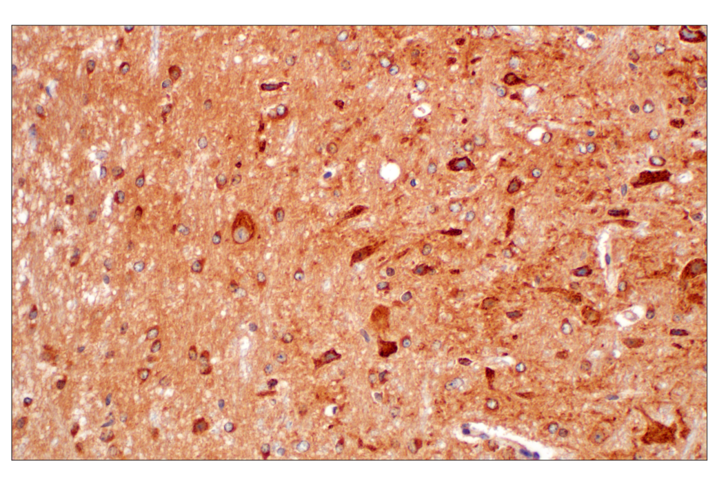 TMEM192: Lysosomal Marker