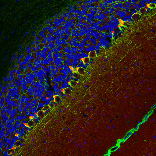 PSD95 Immunofluorescence rat brain