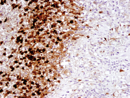 IL-1β (3A6) Mouse mAb #12242