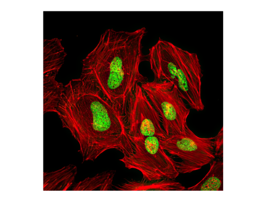 Confocal immunofluorescent analysis of HeLa cells.