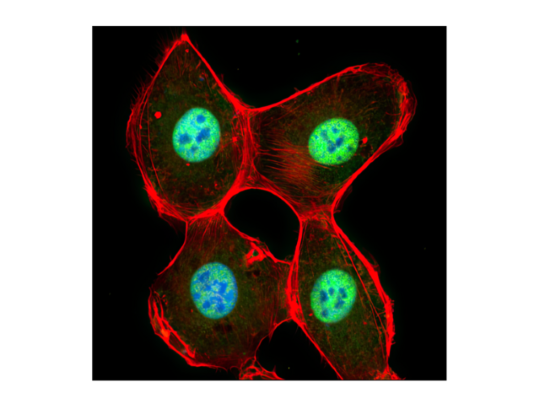 Confocal immunofluorescent analysis of HT-1080 cells.