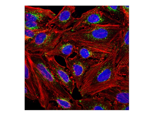 Image of a confocal immunofluorescent analysis of HeLa cells.