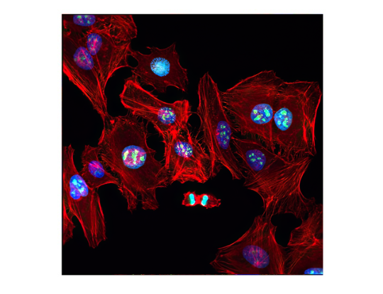 Image of a confocal immunofluorescent analysis of HeLa cells.