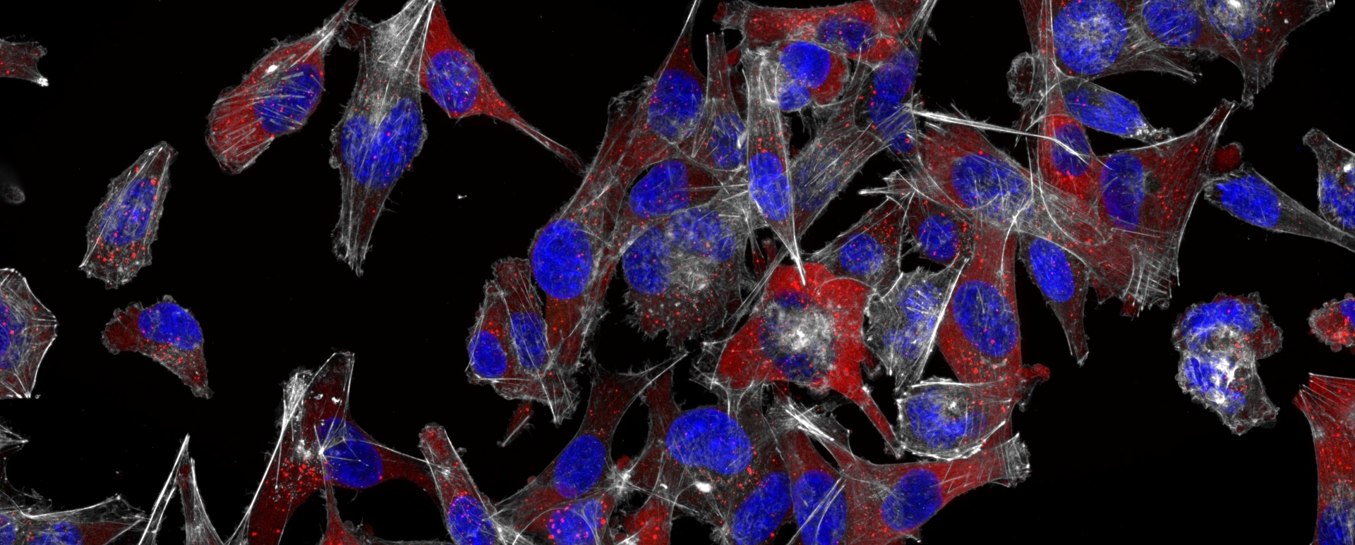 Image of an immunofluorescence assay on untreated SK-MEL-2 cells