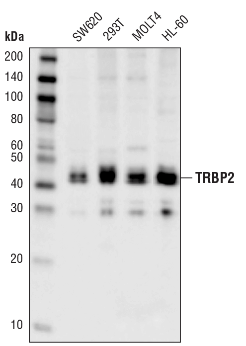 TRBP2 (D7C8K) Rabbit mAb #62043