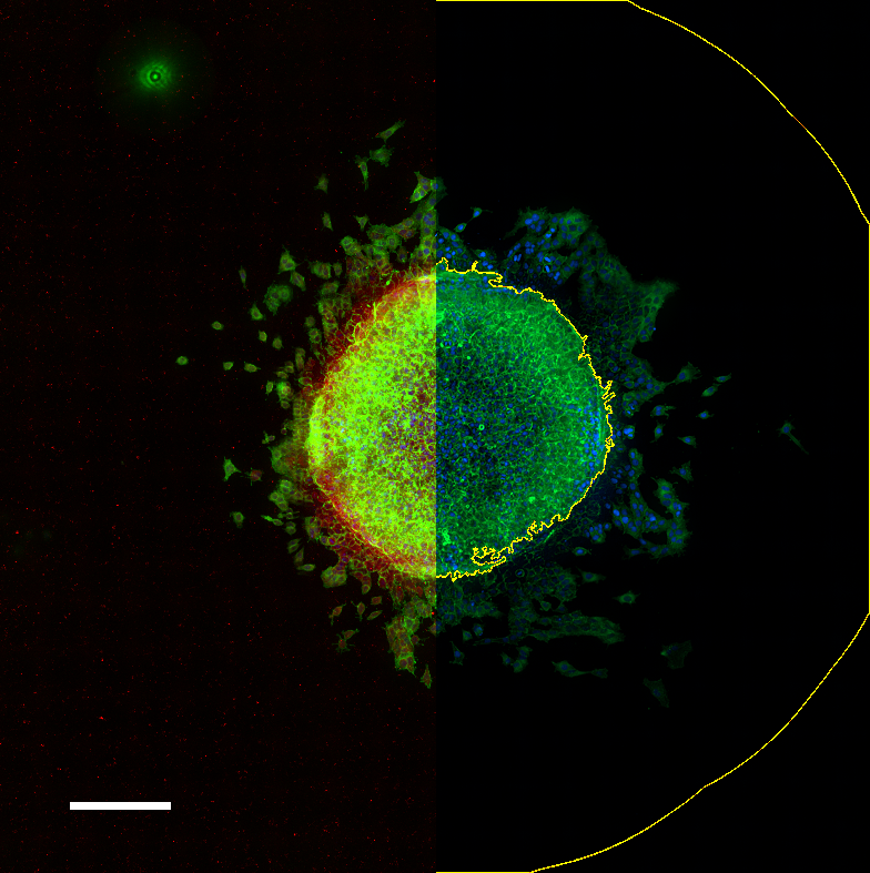 3D/Organoid Imaging Using CST IF/HCS Antibodies