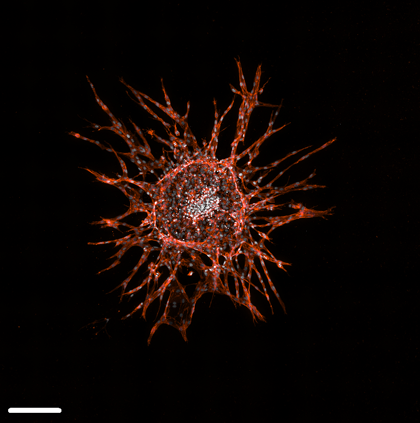 3D/Organoid Imaging Using CST IF/HCS Antibodies