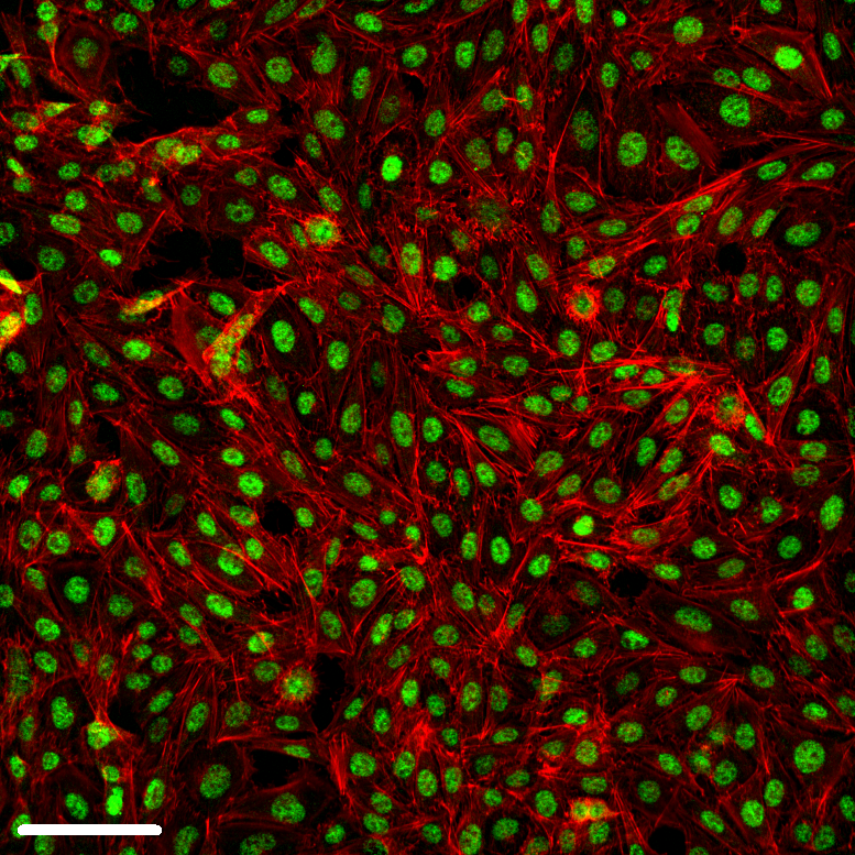 3D/Organoid Imaging Using CST IF/HCS Antibodies