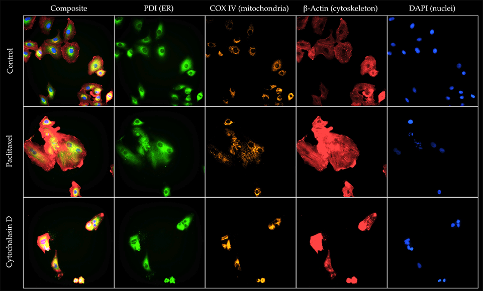 Cell Painting Using CST IF/HCS Antibodies