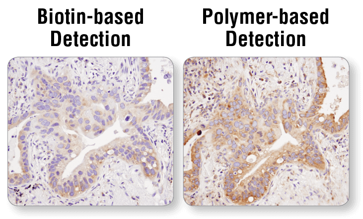 IHC Polymer Biotin Detection