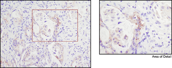 ROS1 (D4D6) Rabbit mAb #3287