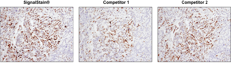 Phospho-Stat3  (Tyr705) (D3A7) XP® Rabbit mAb #9145
