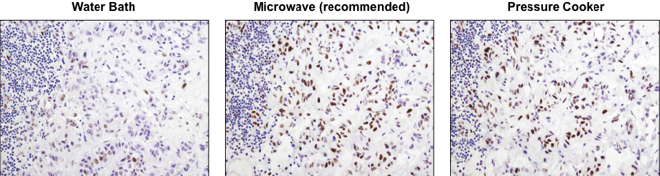 Phospho-Stat3 (Tyr705) (D3A7) XP® Rabbit mAb #9145