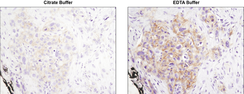 Phospho-HER3/ErbB3 (Tyr1289) (D1B5) Rabbit mAb #2842