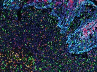 Fluorescent Multiplex Immunohistochemistry