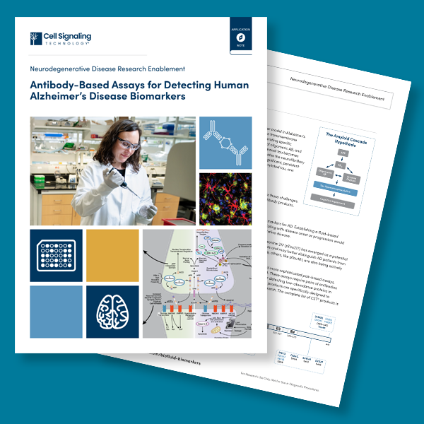 App Note: Antibody-Based Assays for Detecting Human Alzheimer's Disease Biomarkers