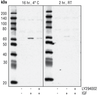 Phospho-Akt (Ser473) Antibody #9271