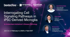 Discover advanced methods for studying TREM2 and downstream signaling in human-relevant iPSC-derived microglia to advance Alzheimer’s disease research.