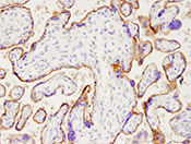 IHC Placenta for PD-L1 (Extracellular Domain Specific)