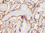 IHC Placenta for PD-L1 (405.9A11)